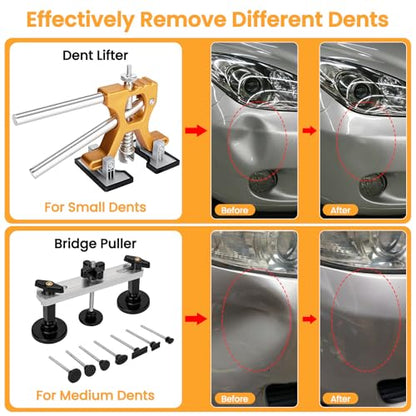 Dent Puller 134PCS Paintless Dent Removal Kit
